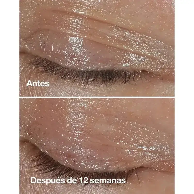 Clinique Smart Clinical Repair Anti-Wrinkle Correcting Eye Cream, 2x15 ml