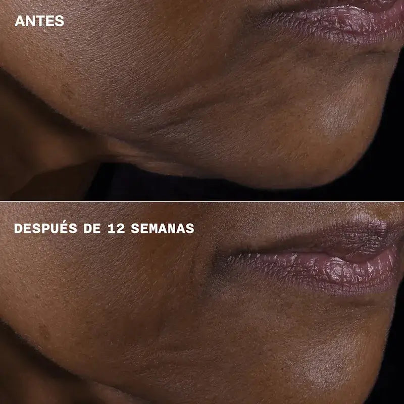 Clinique Smart Clinical Repair Firming + Lifting for Face & Neck, 75 ml