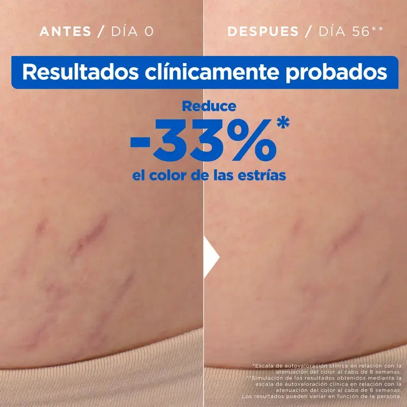 Mixa Anti-Stretch Marks Oil, 100 ml